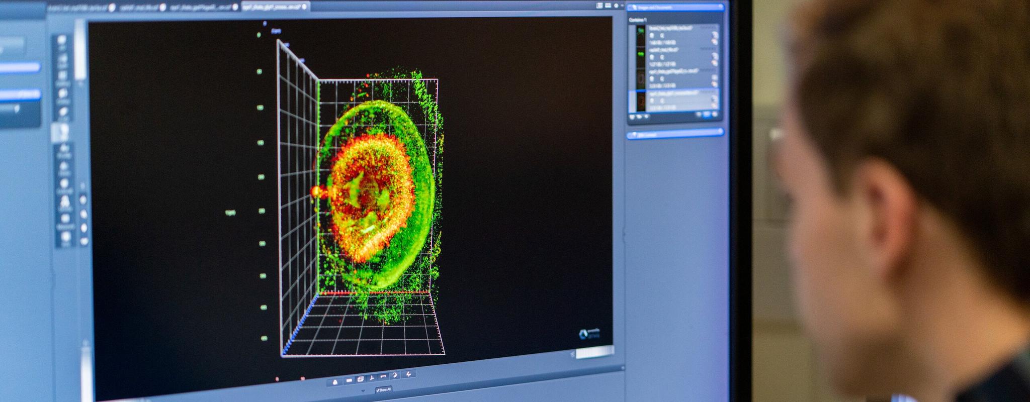 A computer screen shows a 3D reconstruction of the eye of a six day old zebrafish larva