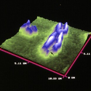 Fragile X chromosome, atomic force microscope