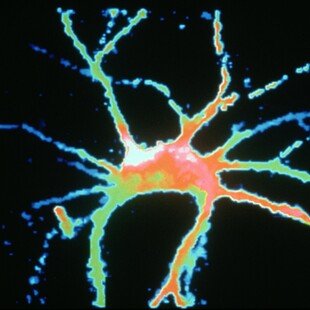 Motorneurone cell in a rat spinal cord