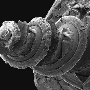 Cochlea of the inner ear