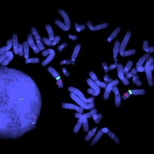 Duchenne muscular dystrophy control, FISH