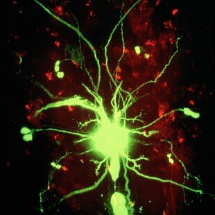 Giant nerve fibre in a fruit fly