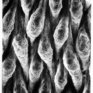 Inner surface of ileum