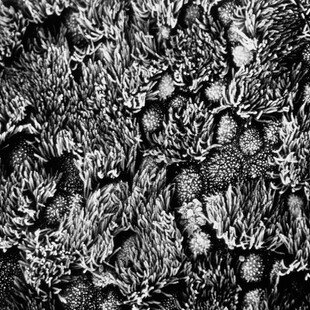 Inner surface of trachea
