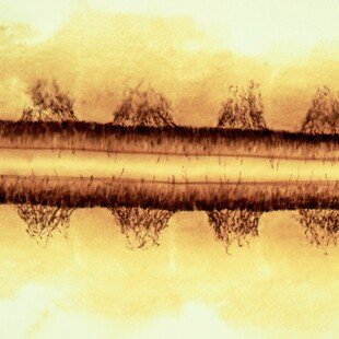 Chick embryo spinal nerves