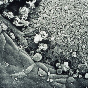 Embryo wound healing SEM