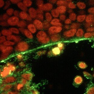 Embryonic wound healing