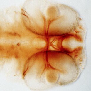 Zebrafish optic chiasm