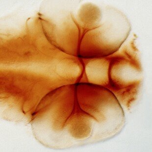 Zebrafish optic chiasm