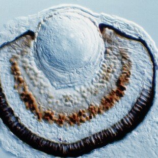 Zebrafish eye development