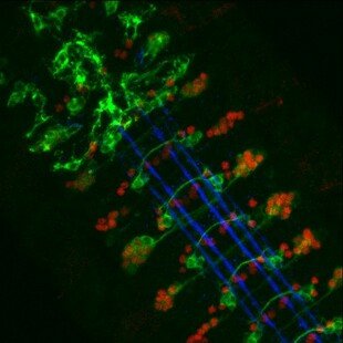 Axons in developing embryo, confocal image