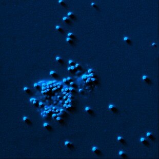 Mast cell releasing histamine granules