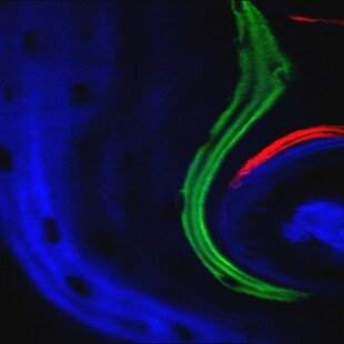 Confocal image of bone growth in culture