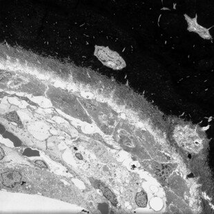 Calcified bone interface showing cell layers