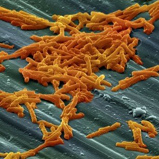 Clostridium difficile