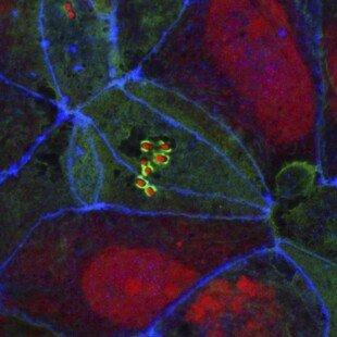 Enteropathogenic E. coli on human intestinal cells