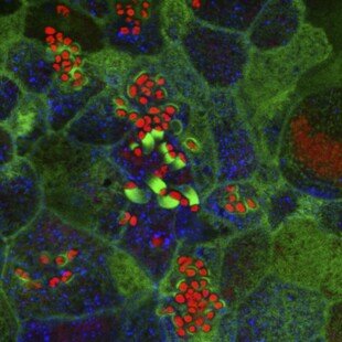 Enteropathogenic E. coli on human intestinal cells