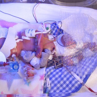 Premature baby in an incubator