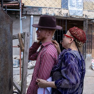 A man and a woman, both with albinism, greet each other.