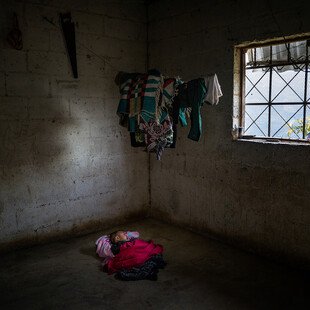 A child suffering from malnutrition sleeps on the ground.